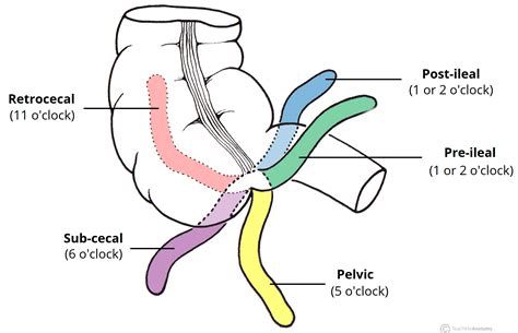The Appendix - Retrocecal - Arterial supply - Appendicitis - TeachMeAnatomy