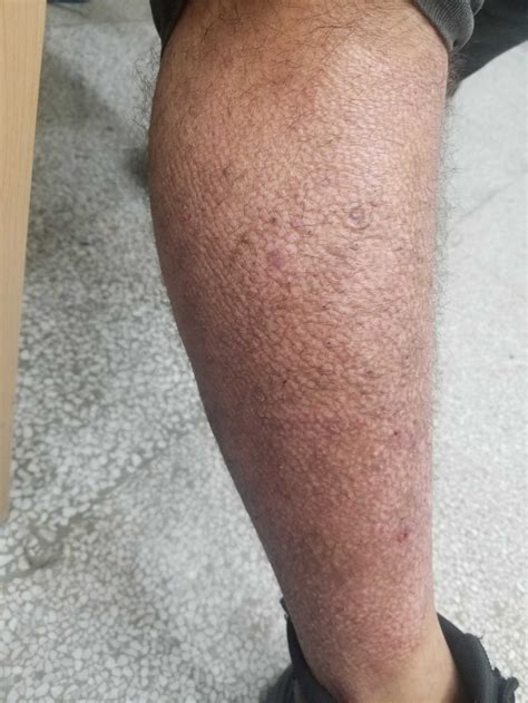 Air resistance – Definition, Formula, Components, Factors