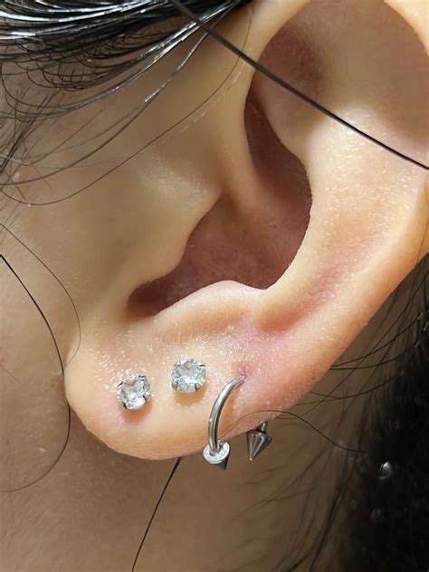 i have a lobe piercing bump that won't heal, what should i do? it's ...