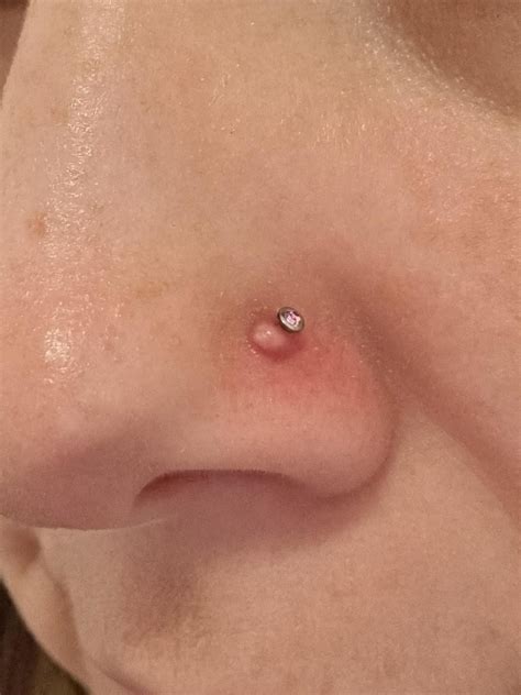 Nose Piercing Bump