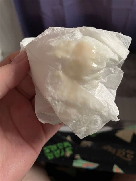 Cottage Cheese Discharge But No Itching Or Burning at Fannie Bearce blog