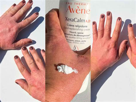 The 7 Best Lotions for Eczema, According to Testers and Dermatologists