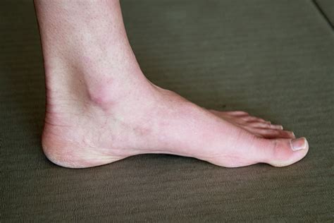 Strengthening the Arches of Your Feet - Core Exercise Solutions | Foot ...