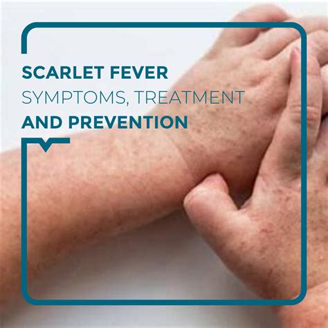 SCARLET FEVER - Alegria Medical Centre