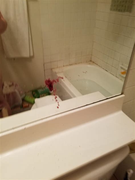 Popped a pilonidal cyst as I went to sit on the toilet a few years back : r/popping