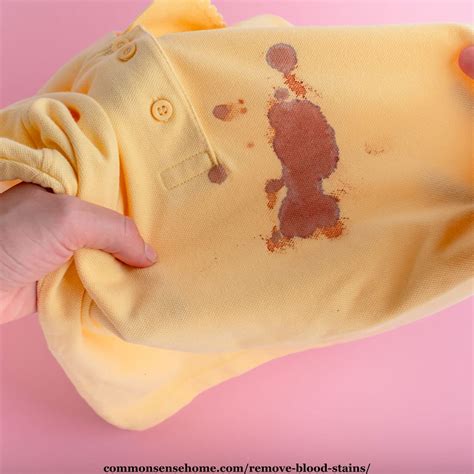 Blood Stained Clothes