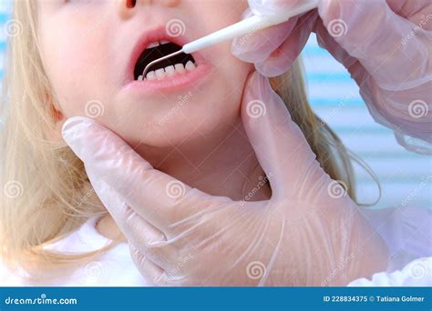 Closeup Female Hands, Dentist, Doctor Examines Oral Cavity of Small ...