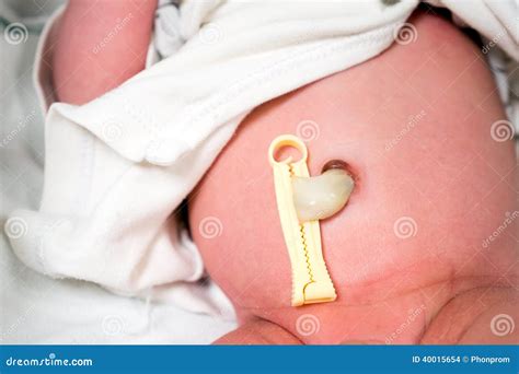 Bathing Newborn Baby With Umbilical Cord at Pablo Joyce blog