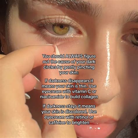 How to Get Rid of Dark Circles, Wrinkles & Bags Under Eyes in 2024 | Natural skin care, Skin ...