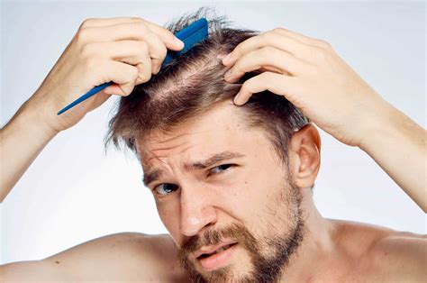 4 Common Causes of Hair Loss in Men - Live Enhanced