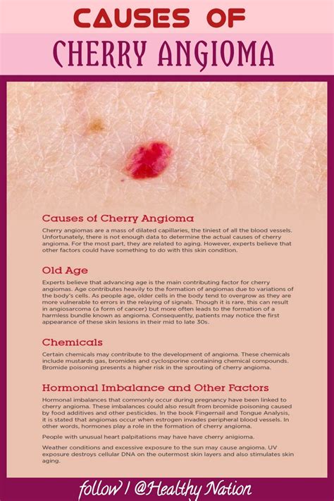 CAUSES OF CHERRY ANGIOMA | Cherry angioma, Red moles, Body