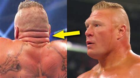 Brock Lesnar Teeth : Breaking Brock Lesnar Retires From Ufc Fitness ...