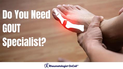 How To Find The Best Gout Specialist Near Me