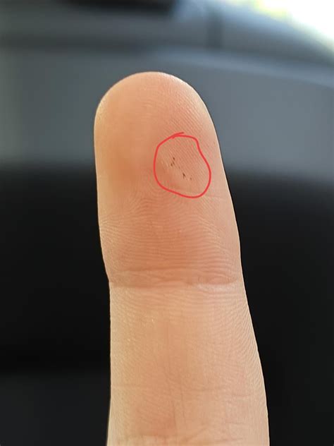 What are these brown/black very small dots on my fingertip? : r/DermatologyQuestions