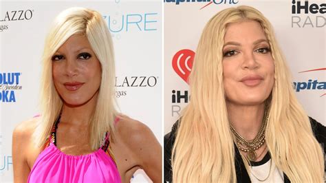 Tori Spelling Plastic Surgery Transformation: Before, After Photos | Life & Style