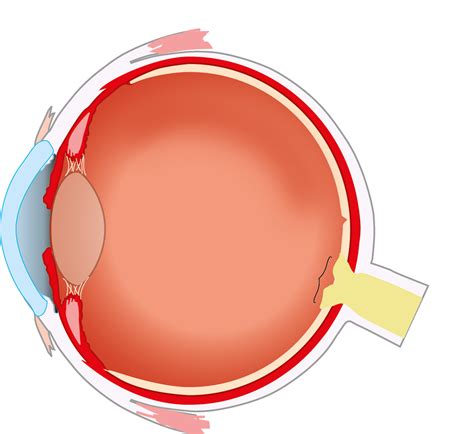 Label The Eye Answers at Jill McCarthy blog