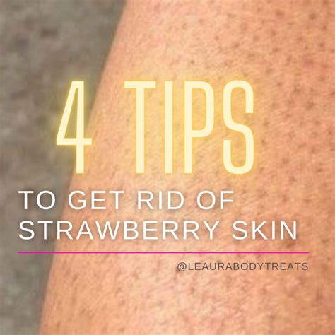 How to get rid of strawberry skin (4 tips for preventive care) – Leaura Body Treats