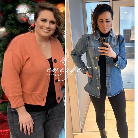 Before and after photos in Tulsa, Oklahoma | Emerge