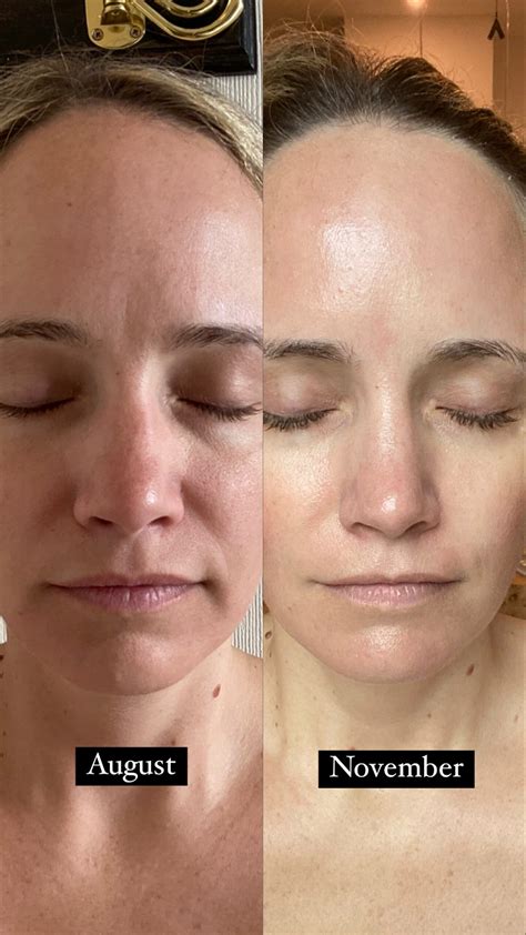 Grandelash MD Lash Enhancing Serum Review - The Stripe