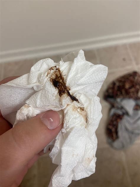 Top 999+ implantation bleeding images – Amazing Collection implantation ...