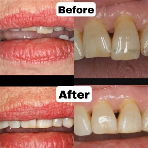 Cosmetic Dentistry Cost