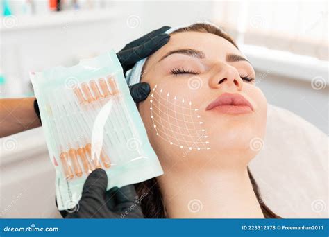 Facial Lifting Thread. Thread Facelift with Arrows on Face for Woman& X27;s Skin, Procedure ...