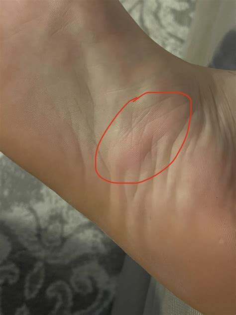I have been having sharp pain on the bottom of my foot for a few weeks ...