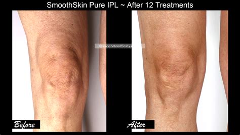 How To FIX Crepey Skin! – hotandflashy.com