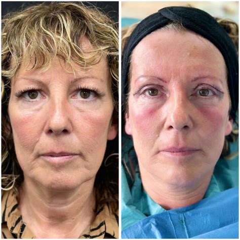 Mr Irfan Jeeva - The Tweakments Guide