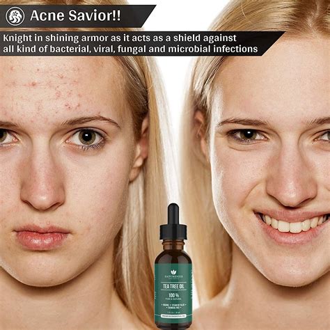 Naturenics Tea Tree Essential Oil - 100% USDA Organic Melaleuca Alternifolia - Therapeutic Grade ...