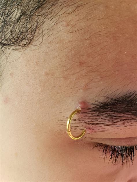 is my eyebrow piercing infected? : r/PiercingAdvice
