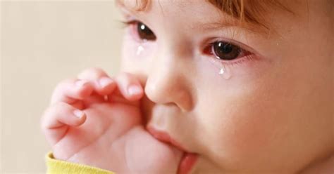 The Watery Eye Causes and Treatment | Paediatric Eye Care
