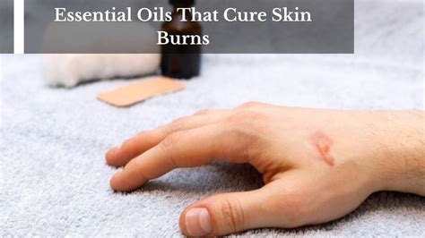 Burn From Skin Products at Kristie Rhodes blog