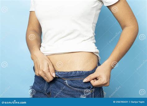 Women Show Off the Belly after Birth. Stretch Marks on Blue Background ...