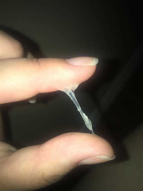 Is this early pregnancy discharge? : pregnancyproblems