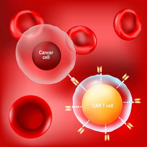 CAR-T Cell Treatment in Turkey | Check 2026 Cost & Prices