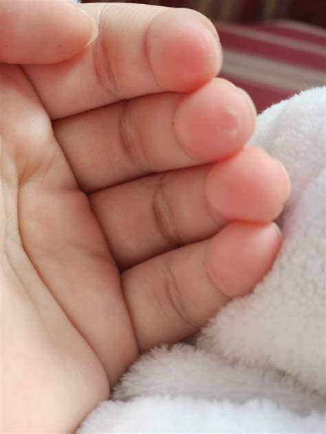 Day 2 of tracking my progress by taking pictures of my fingers : r ...