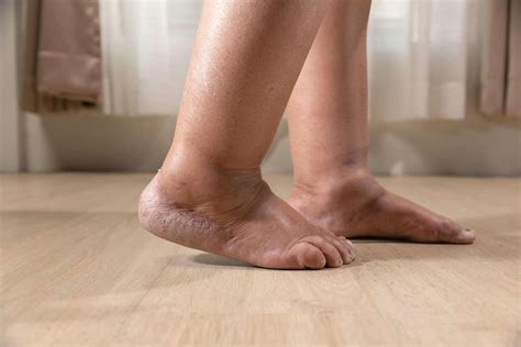 When to See a Podiatrist for Foot Pain | CLS Health