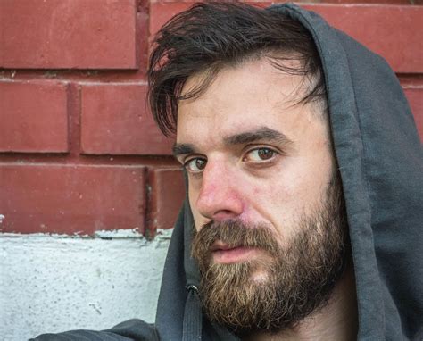 Red Face From Drinking Alcohol - Signs & Symptoms | Renewal