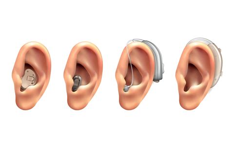 重聽不戴助聽器，失智風險增！如何挑選助聽器？可以外觀看不出來嗎？｜銀天下