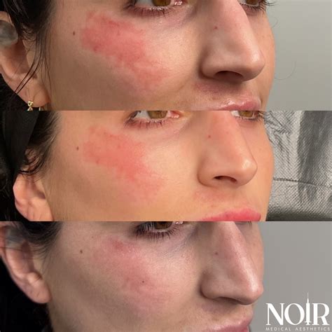 Neeki Ostad FNP, CANS | Noir Medical Aesthetics (@neeki_noirmedicalaesthetics) • Instagram ...