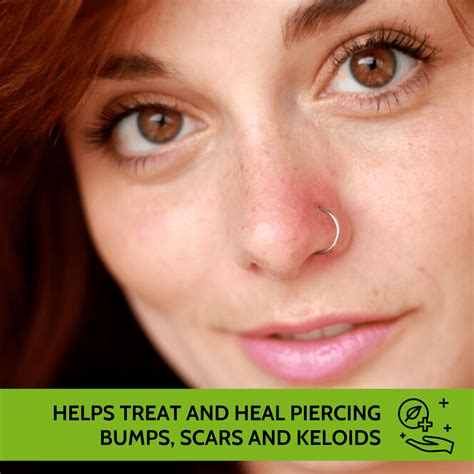 Antibiotic Cream On Nose Piercing Bump at Mia Rooke blog