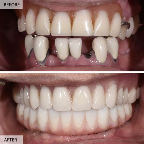 Before After: Khám Phá Những Biến Đổi Ấn Tượng Trong Cuộc Sống