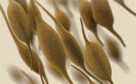 Is a Mycoplasma Infection associated with Bacterial Vaginosis?