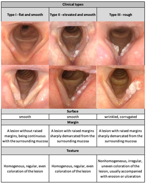 Videolaryngoendoscopic and Stroboscopic Evaluation in Predicting the Malignancy Risk of Vocal ...