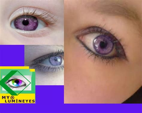 Violet Eyes: Rare Eye Color, Causes And Medical Facts
