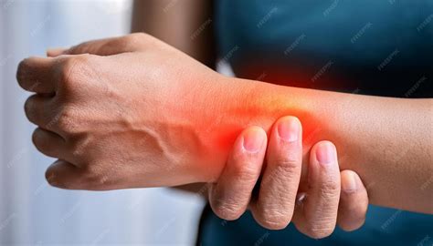 Wrist Tendonitis CloseUp with Mild Swelling and Visible Inflammation ...