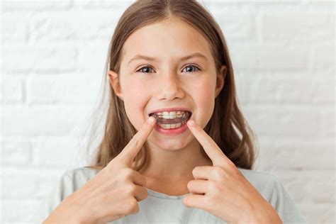 Children and Crooked Teeth | Children's Orthodontic Treatment