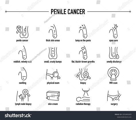 13 External Genital Examination Royalty-Free Images, Stock Photos ...