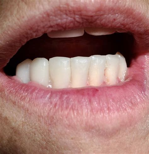 Colorado Springs Dentist | Tuttle Family Dentistry